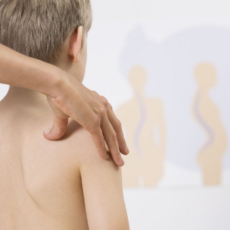 Physiotherapist correcting kids faulty posture with her hands